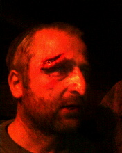 Resident assaulted by men in masks in Ingushetia's Nesterovskaya